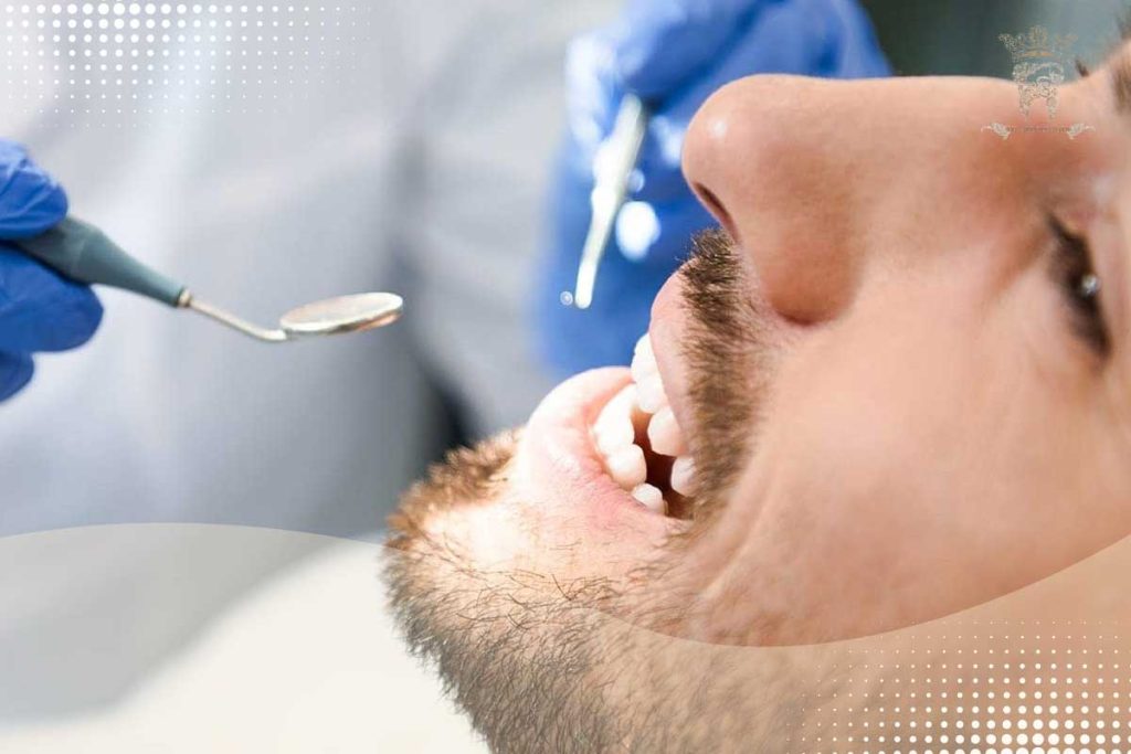 کانتکت لنز دندان