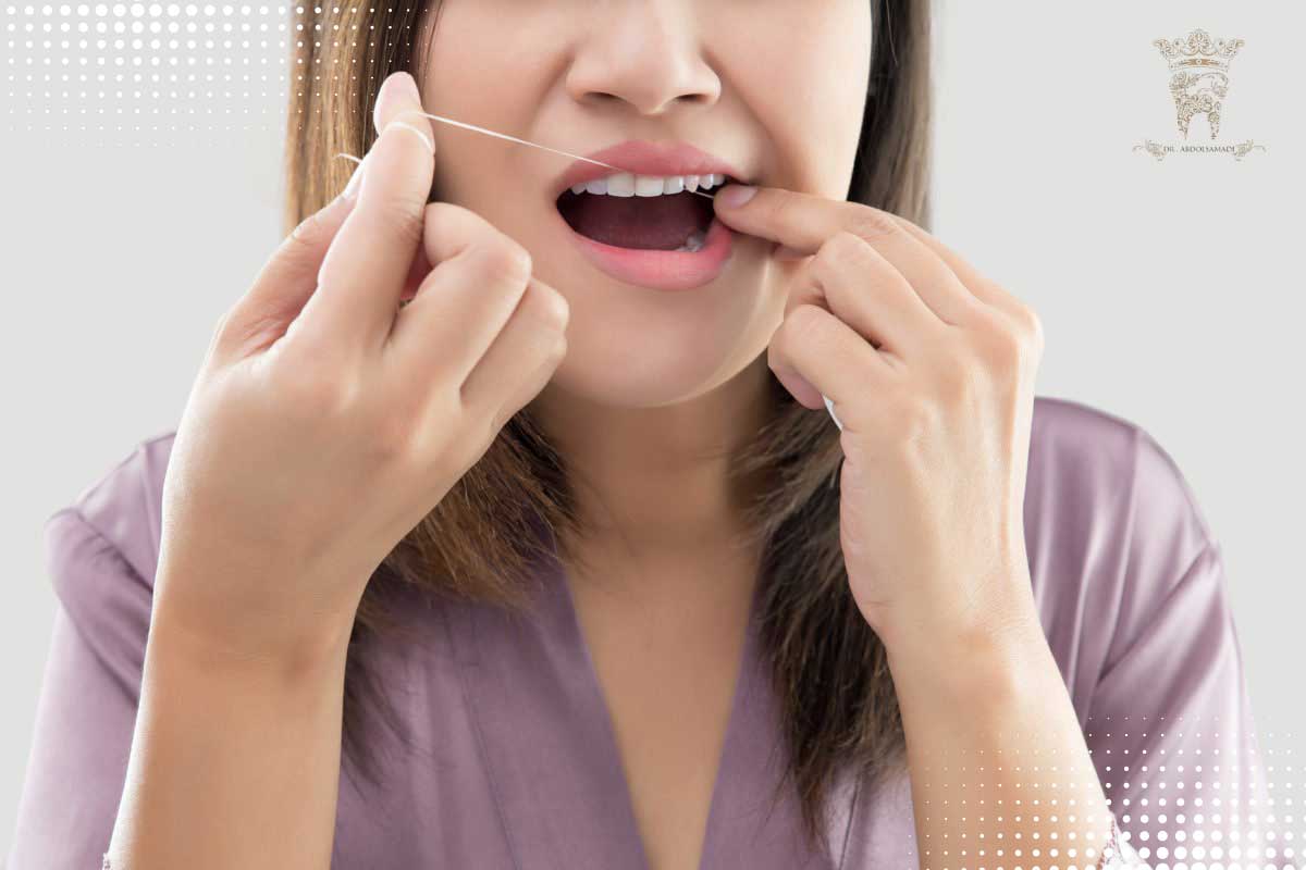روش تمیز کردن و مراقبت از لمینت ‌های متحرک فوری دندان