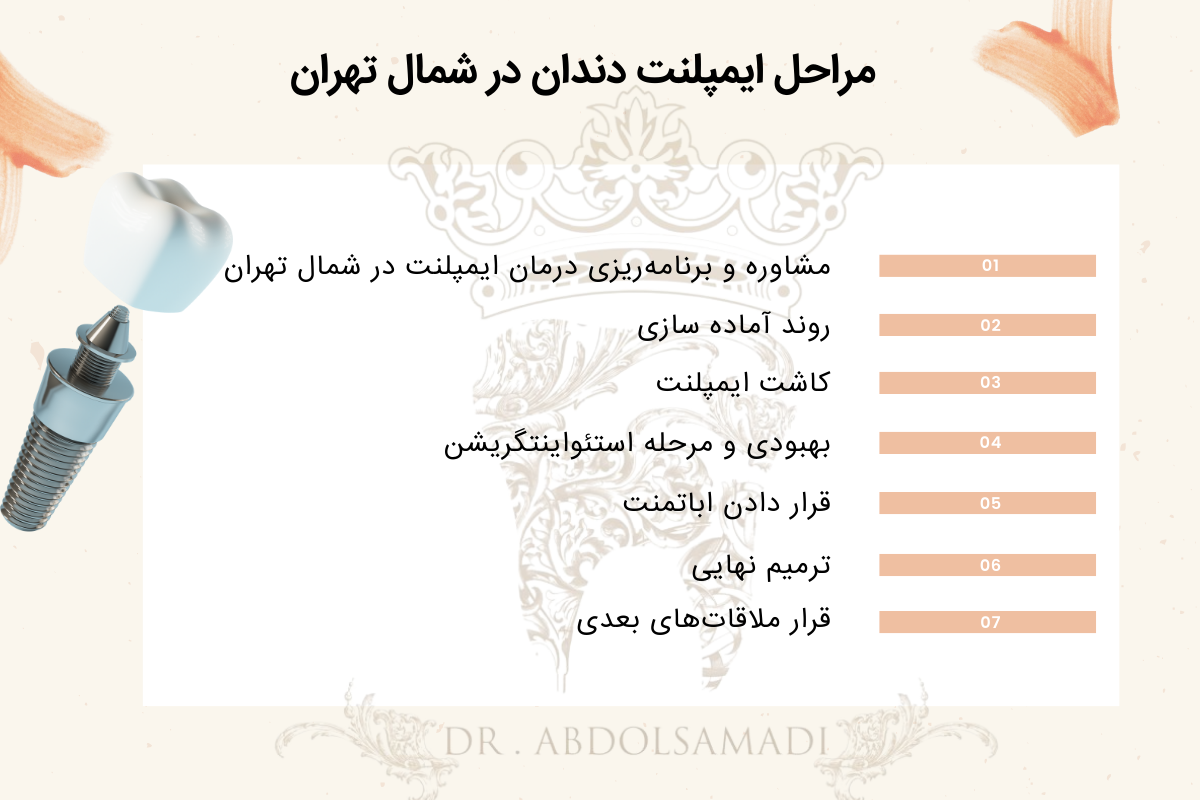 بهترین دندانپزشک ایمپلنت دندان در شمال تهران: ایمپلنت دندان در منطقه یک 6 مراحل انجام ایمپلنت دندان در شمال تهران