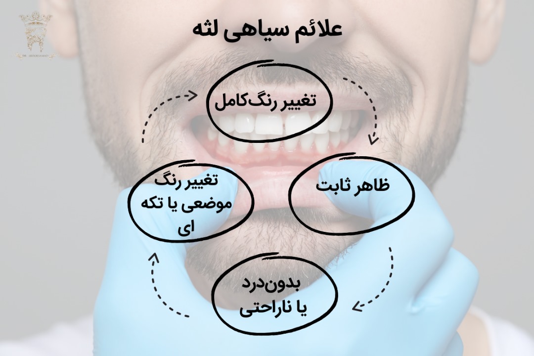 علائم سیاه شدن لثه