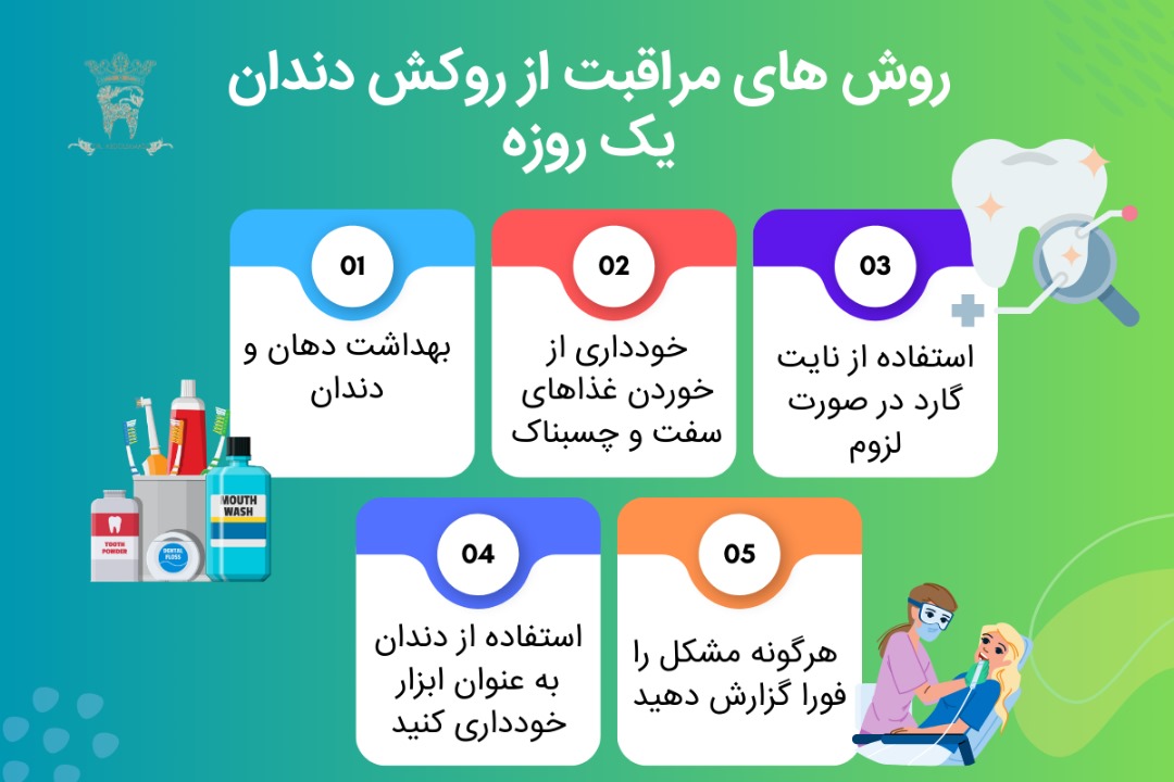 منظور از روکش دندان یک روزه یا فوری چیست؟ 3 مراقبت از روکش دندان یک روزه