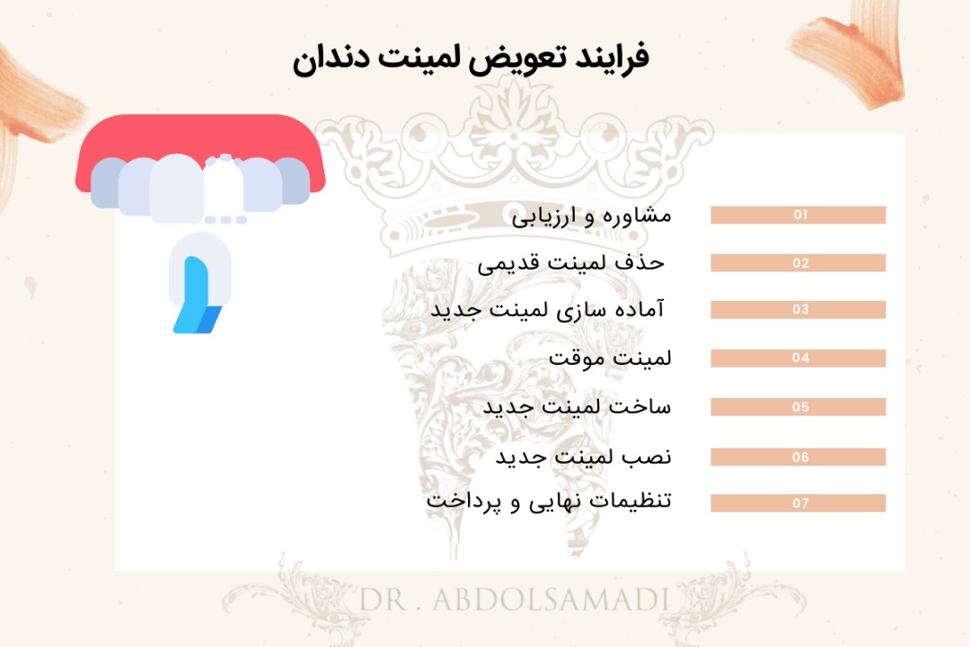 فرایند تعویض لمینت دندان 