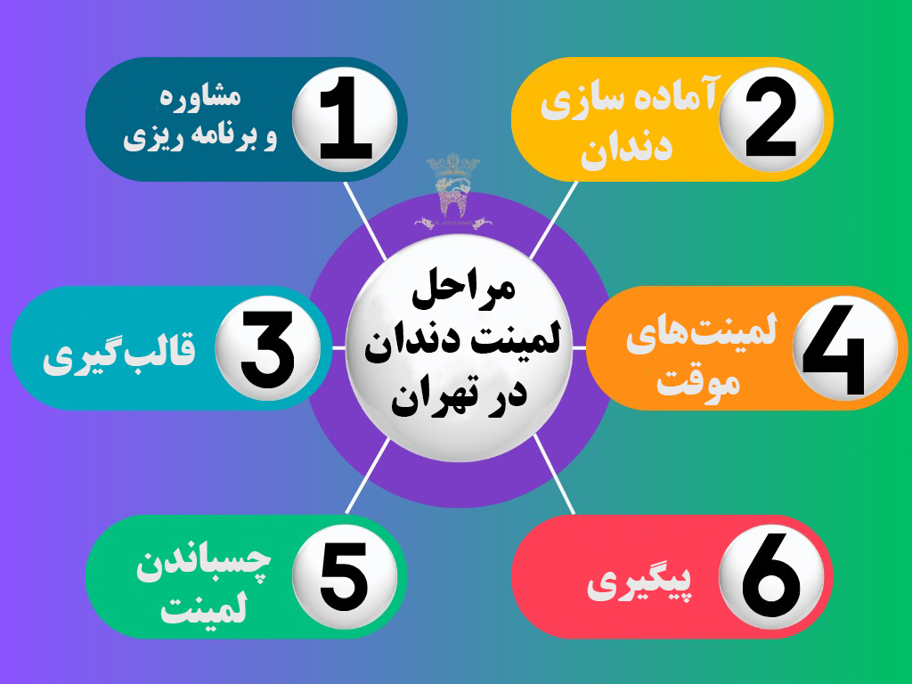 مراحل لمینت دندان در تهران