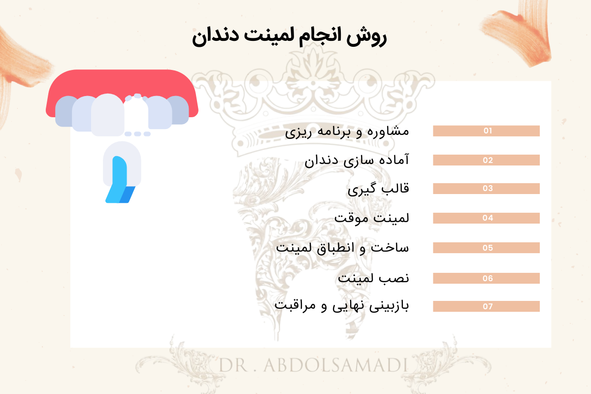 روش انجام لمینت سرامیکی 