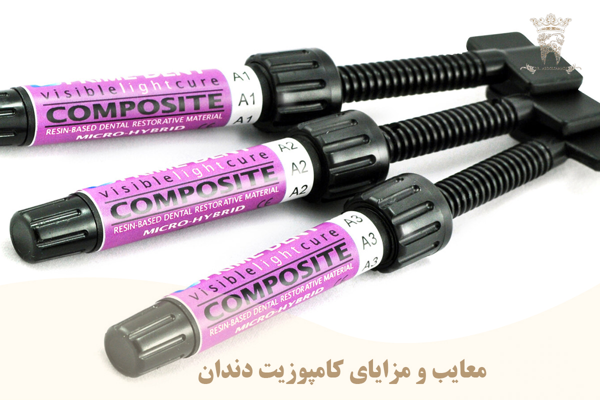 کامپوزیت دندان یا لمینت: بررسی مزایا و معایب هر کدام 2 معایب و مزایای کامپوزیت دندان