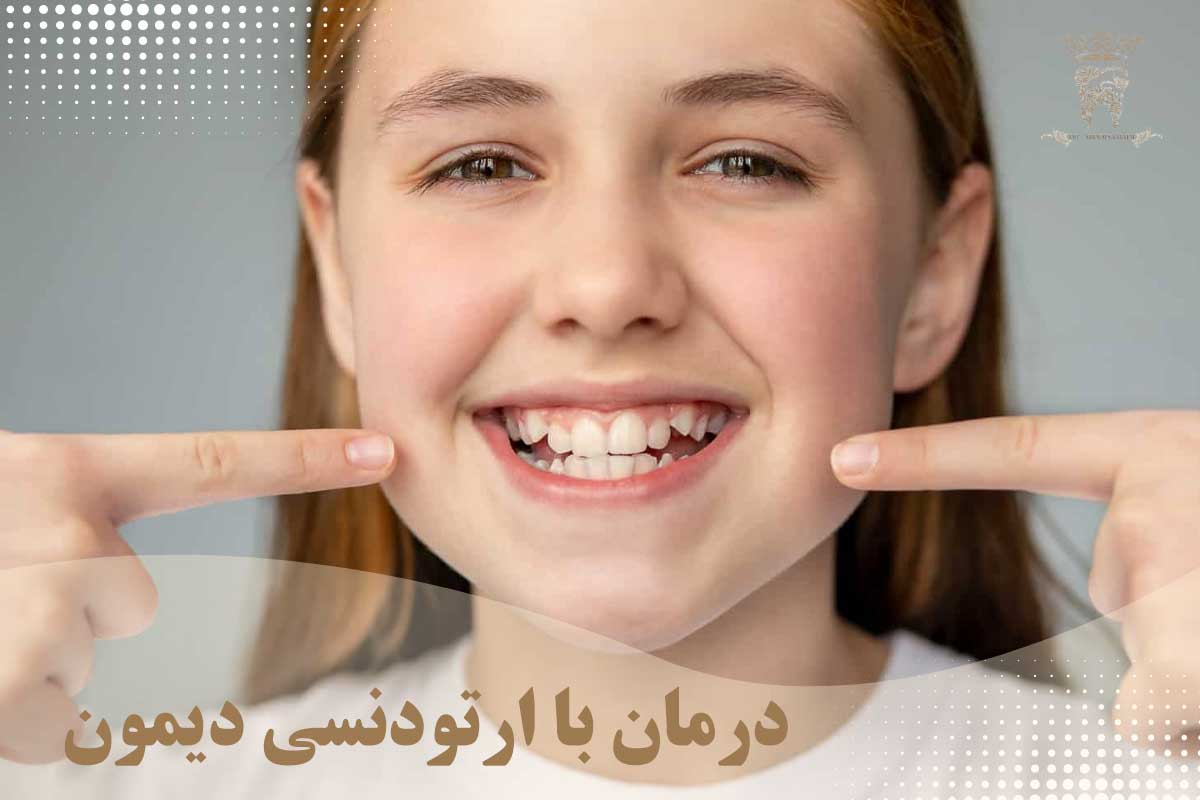 ارتودنسی به روش دیمون چیست و چه مزایایی دارد؟ 5 درمان با ارتودنسی دیمون