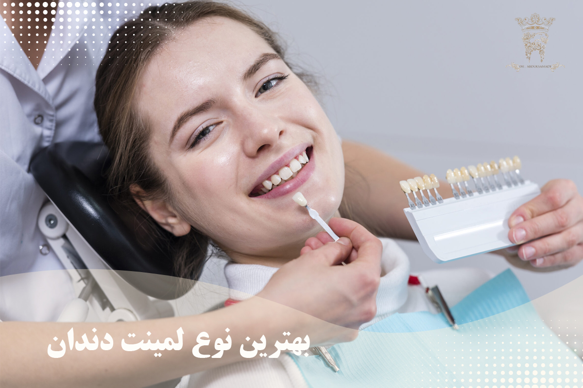 قیمت لمینت دندان 1404 (لمینت دندان در تهران) 17 بهترین نوع لمینت دندان