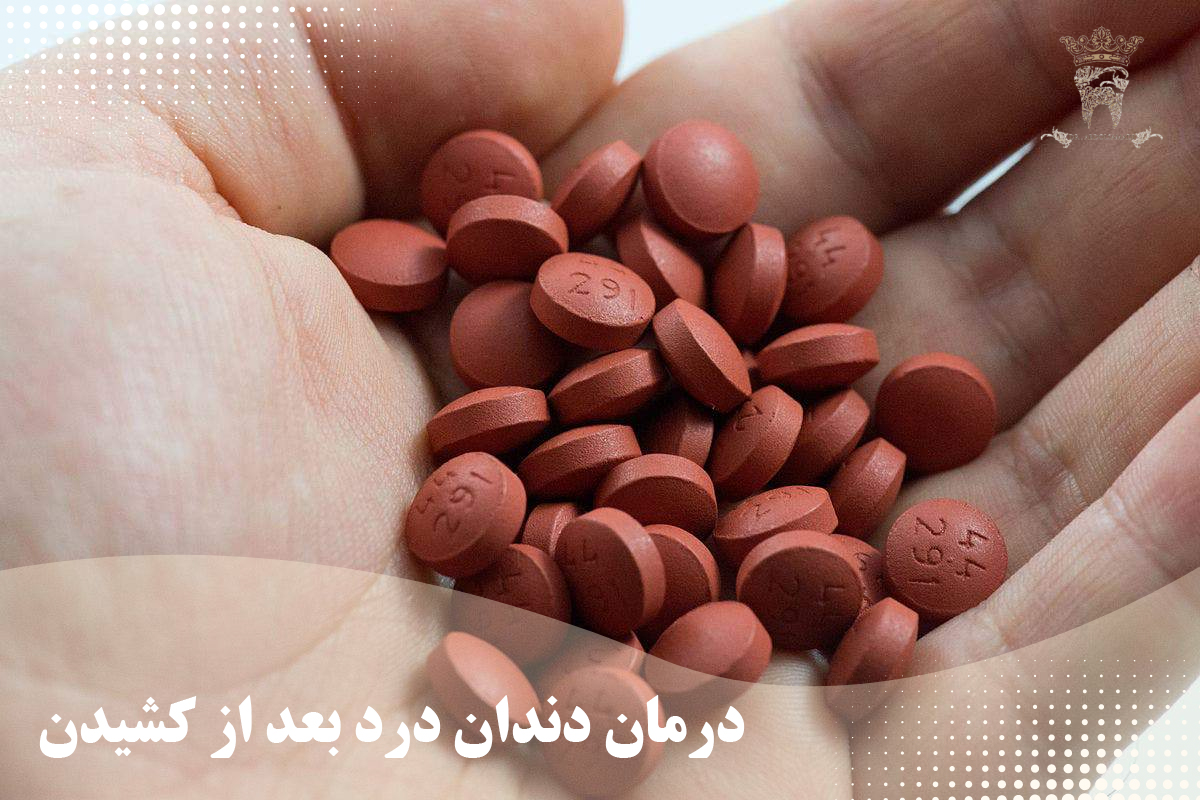 بهترین مسکن برای درد دندان کشیده شده کدام است؟ 3 روش های درمان دندان درد بعد از کشیدن