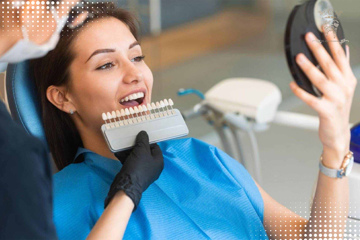 بررسی انواع لمینت دندان (انواع لمینت دندان از نظر برند و بررسی قیمت لمینت دندان) 6 رنگ لمینت دندان