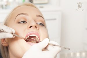 بهترین سن برای کامپوزیت دندان