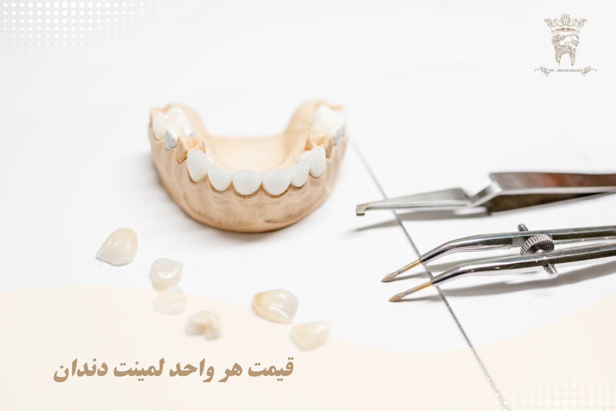 منظور از هر واحد لمینت دندان چیست؟ (دکتر عبدالصمدی) 1 قیمت هر واحد لمینت دندان