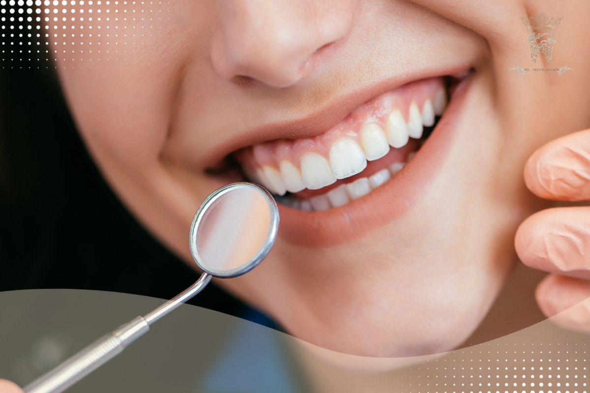 لمینت متحرک دندان؛ مزایا و قیمت خرید 2 مزایای لمینت متحرک دندان چیست؟