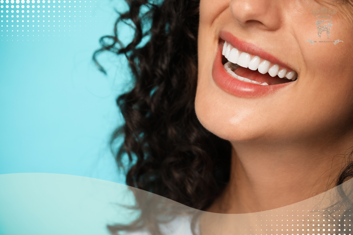 لمینت متحرک دندان؛ مزایا و قیمت خرید 7 جایگزین مناسب لمینت متحرک دندان