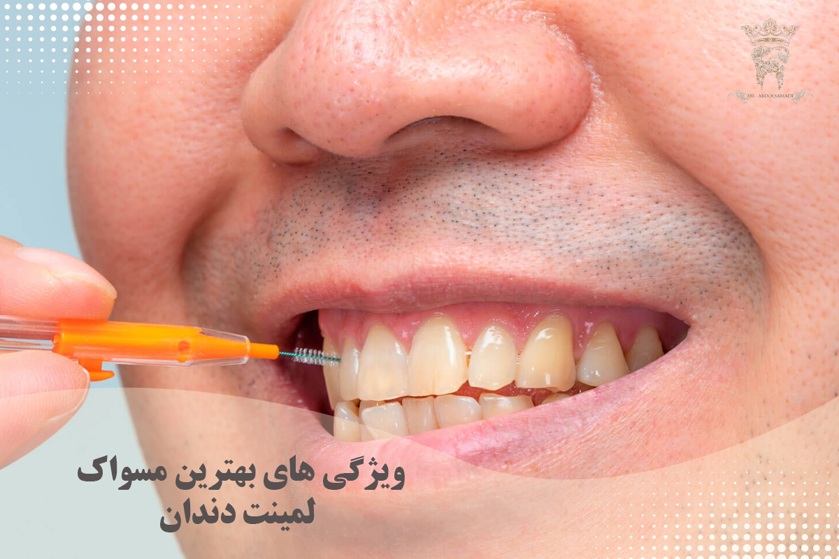 نحوه انتخاب مناسب ترین مسواک لمینت دندان 2 ویژگی های بهترین مسواک لمینت دندان