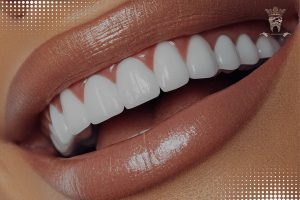 ژل سفید کننده دندان فوری