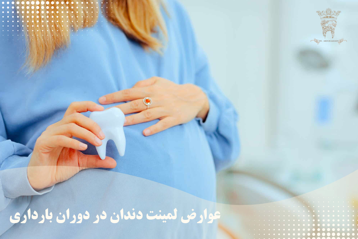 آیا لمینت دندان در دوران بارداری امکانپذیر است؟ 2 عوارض لمینت دندان در دوران بارداری