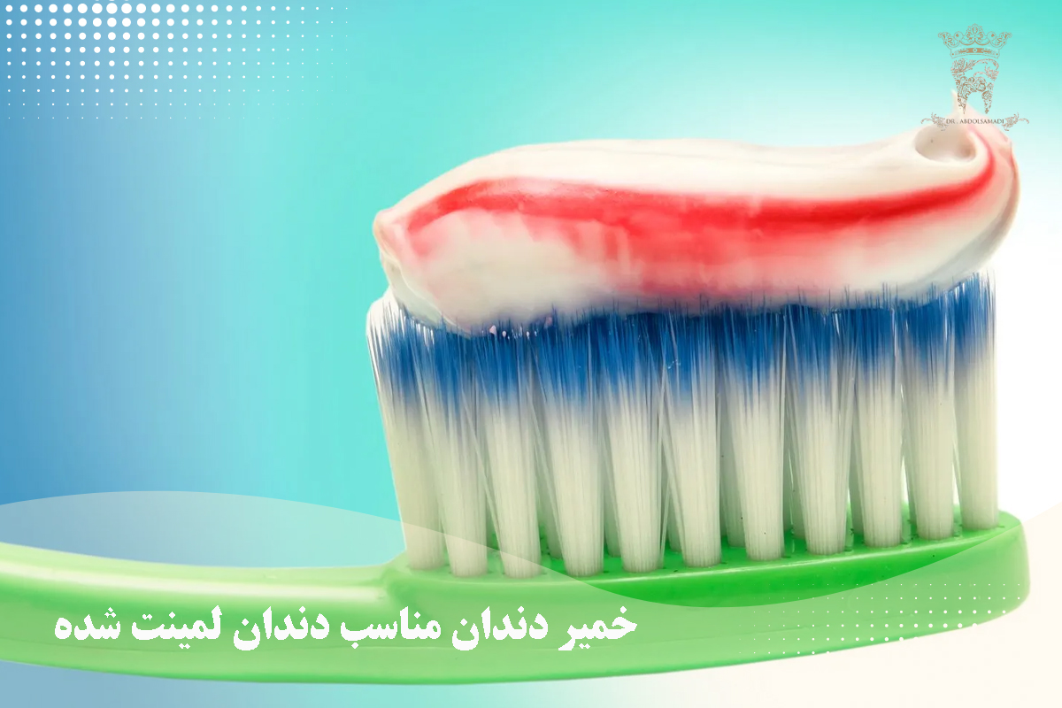 مراقبت پس از درمان لمینت دندان 4 خمیر دندان مناسب دندان لمینت شده