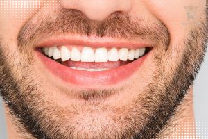 روکش دندان بدون پایه
