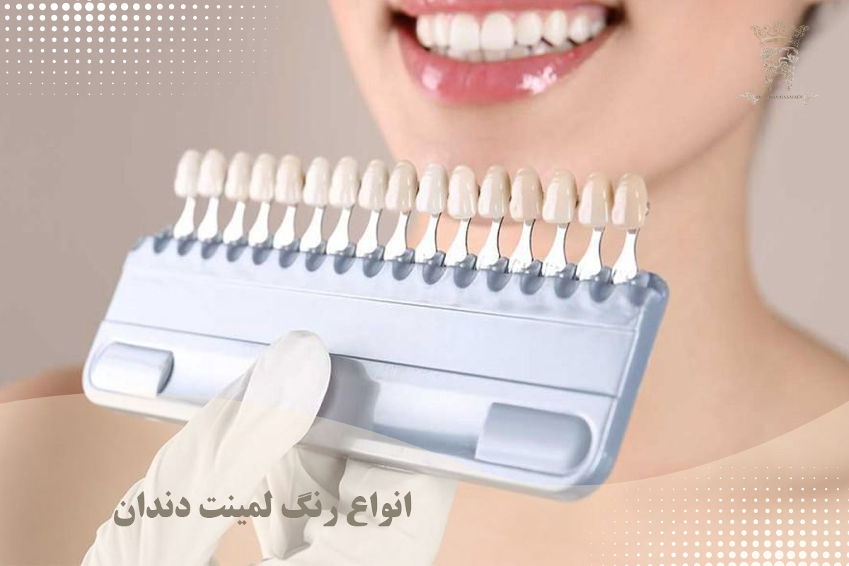 انتخاب رنگ لمینت دندان در طراحی لبخند 1 انواع رنگ لمینت دندان
