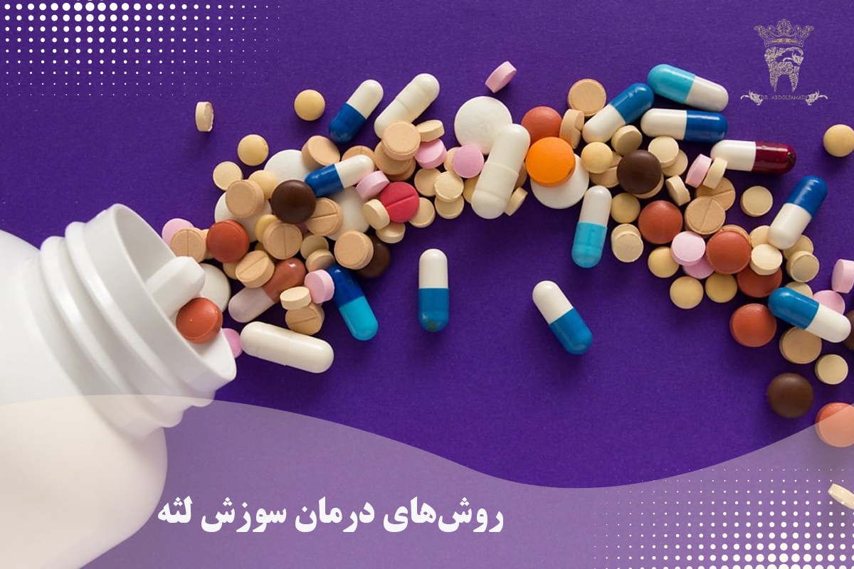 علتهای رایج سوزش لثه و روشهای پیشگیری 2 روشهای درمان سوزش لثه