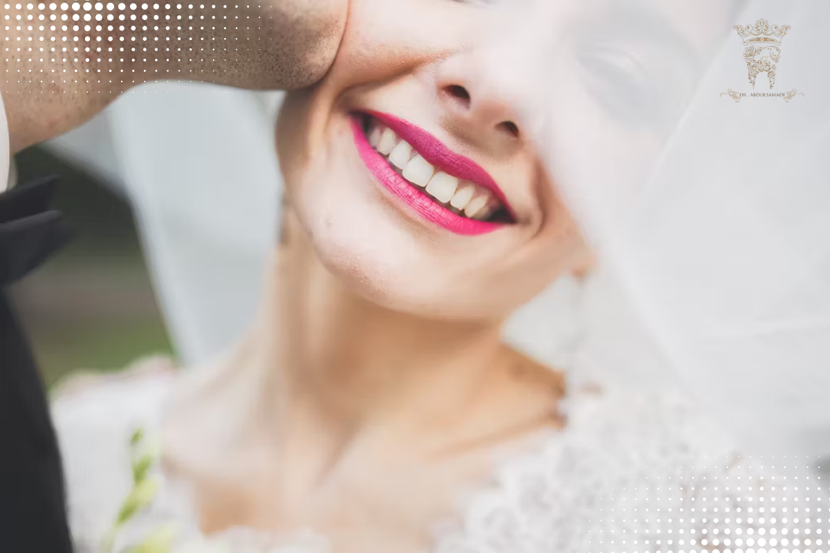 چرا اصلاح لبخند عروس در دندانپزشکی اینقدر محبوب شده است؟ 3 تعداد جلسات برای اصلاح لبخند عروس