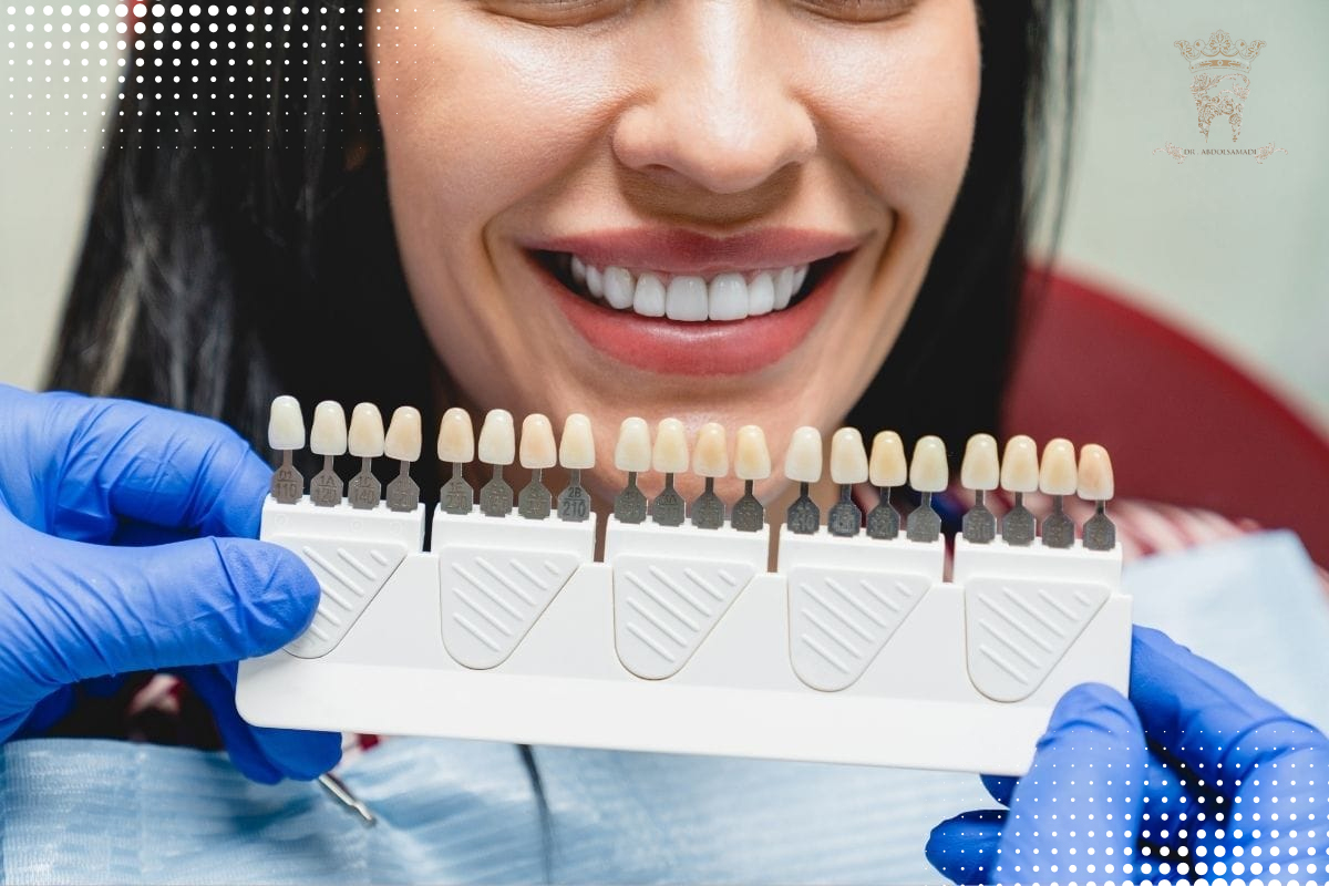 لمینت دندان دیجیتال در تهران | طراحی لبخند دقیق با دکتر عبدالصمدی 1 تفاوت لمینت دندان دیجیتال با لمینت سنتی