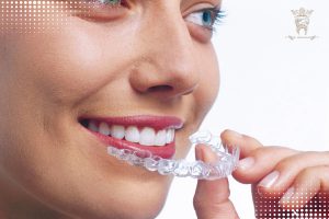 ارتودنسی اینویزلین