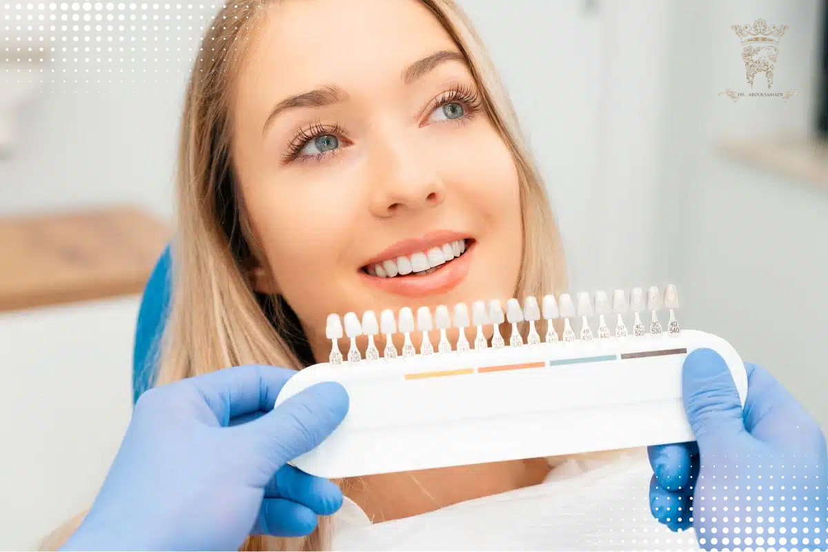 لومینیرز و لمینت دندان: آیا لومینیرز همان لمینت دندان است؟ 3 مراحل انجام لومینیرز دندان