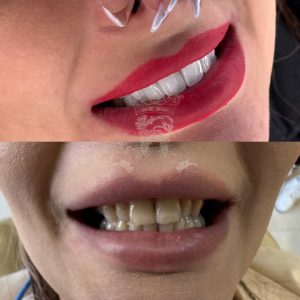 صفر تا صد طراحی لبخند دیجیتال (طرح لبخند) 23 432984324