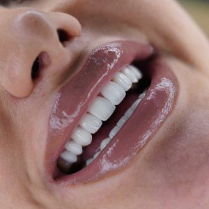 صفر تا صد طراحی لبخند دیجیتال (طرح لبخند) 16 4382784732
