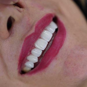صفر تا صد طراحی لبخند دیجیتال (طرح لبخند) 22 94328948324