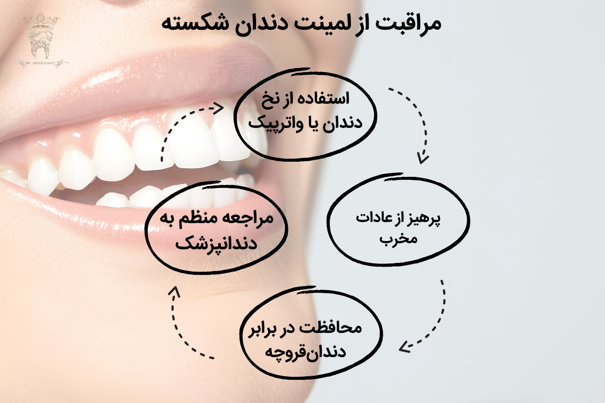 لمینت برای دندان شکسته یا ترک خورده 4 مراقبت از لمینت دندان شکسته