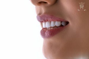 لمینت برای دندان شکسته