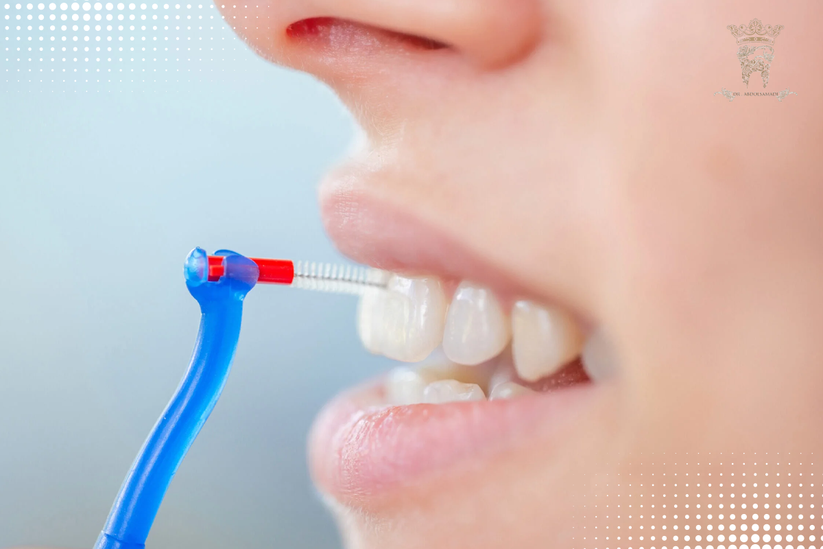 مسواک بین دندانی چیست و چه کاربردی دارد؟ 2 روش صحیح استفاده از مسواک بین دندانی