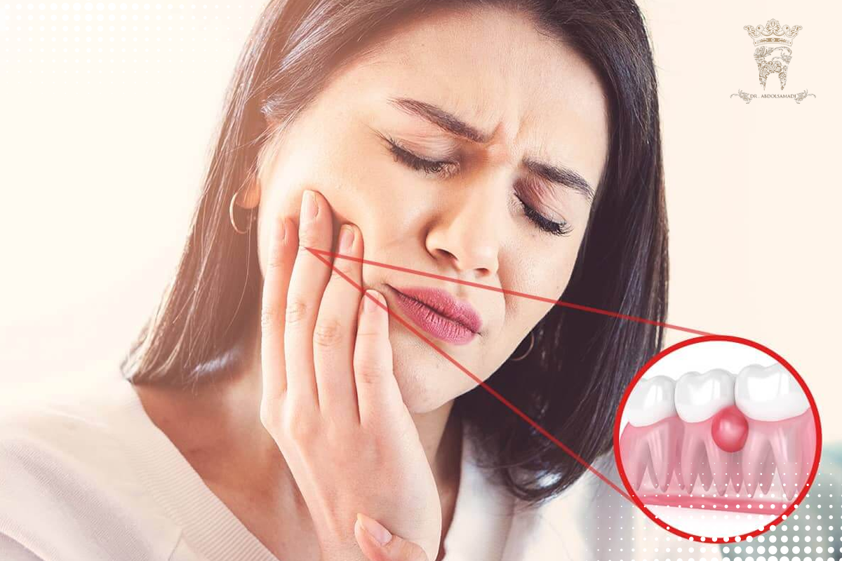 روشهای فوری و خانگی برای خارج کردن عفونت دندان :چگونه عفونت دندان را خارج کنیم؟ 6 تخلیه خانگی عفونت دندان