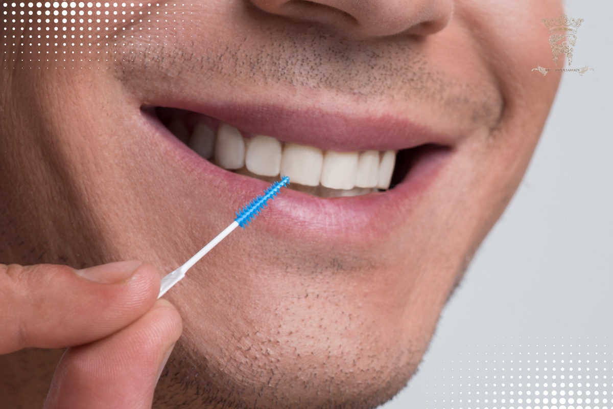 Interdental toothbrush