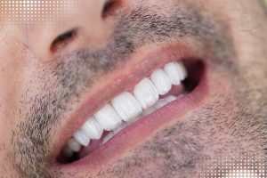 اصلاح طرح لبخند مردانه