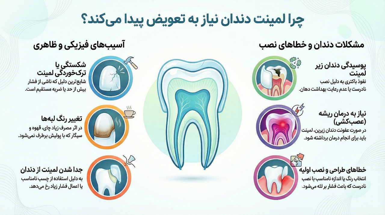 تعویض لمینت دندان: چه زمانی لمینت دندان را باید تعویض کرد؟ 2 Reasons for needing to replace dental laminates