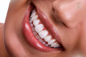 اصلاح طرح لبخند بدون ارتودنسی