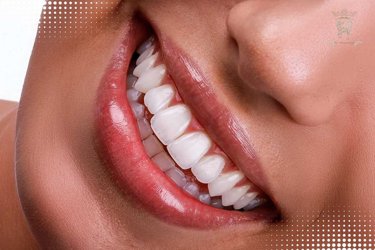 اصلاح طرح لبخند بدون ارتودنسی