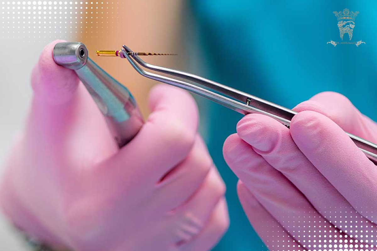 چگونه درد دندان به عصب رسیده را کم کنیم؟ 4 روشهای تخصصی دندانپزشکی برای درمان درد عصب دندان