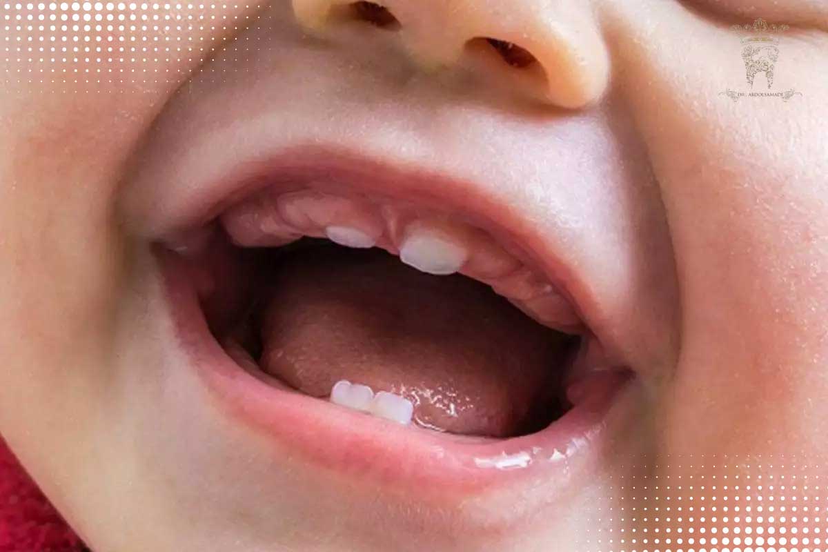 آناتومی دندان؛ ساختار، انواع دندانها و تفاوت دندانهای شیری و دائمی 7 آناتومی دندانهای شیری و دائمی