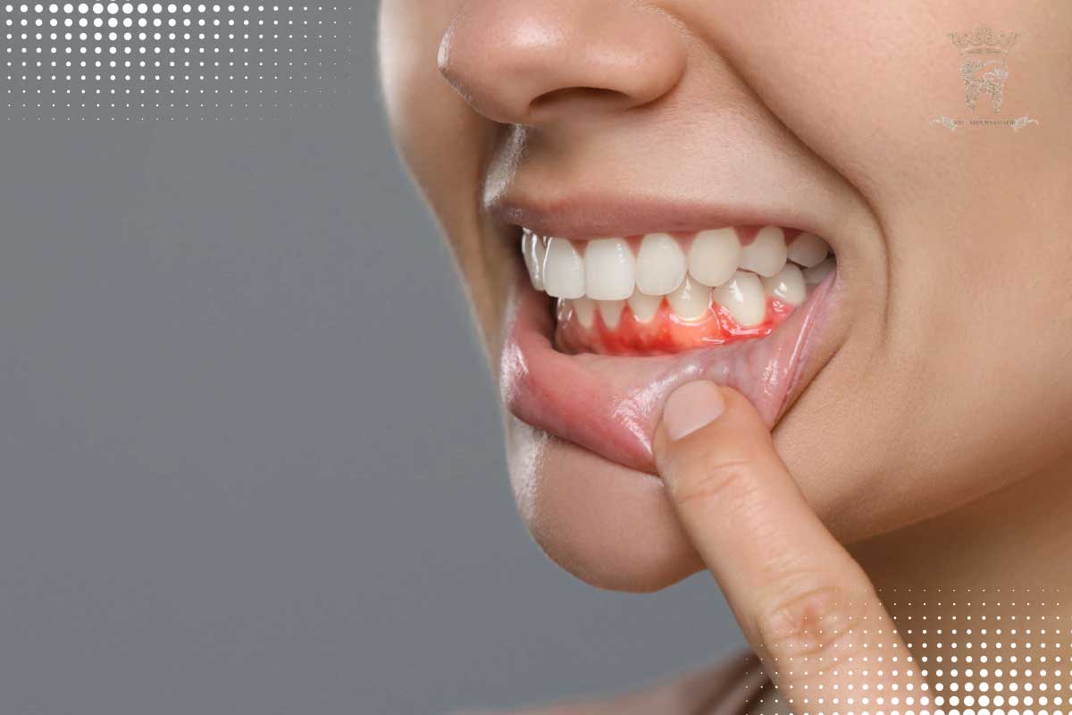 ۵ علت باز ماندن دهان در خواب چیست؟ 3 عوارض باز ماندن دهان در خواب