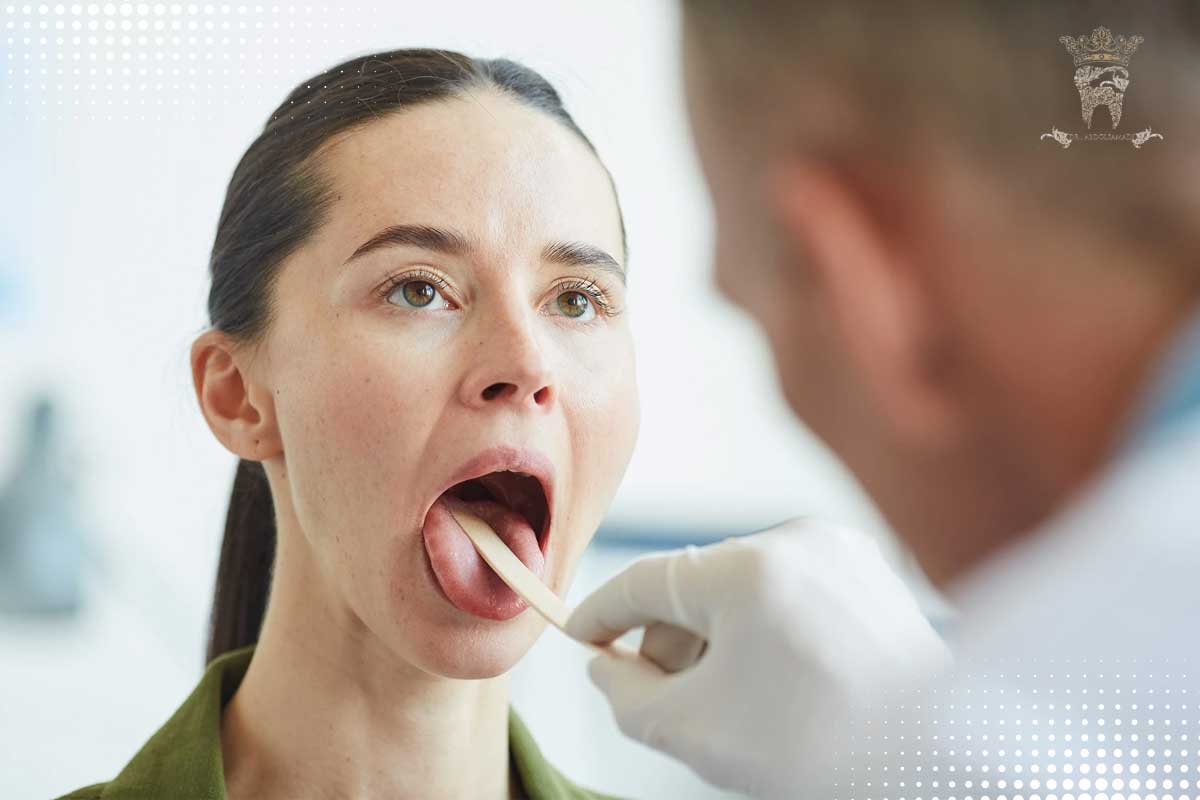 آشنایی کامل با سندرم سوزش دهان 2 نحوه تشخیص سندرم سوزش دهان (BMS)