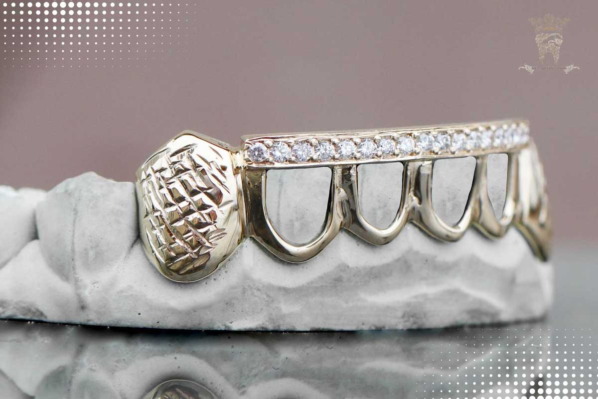 گریلز دندان؛ زینتی و لوکس یا تهدیدی برای سلامت دهان؟ 4 مراقبتها و نگهداری صحیح از گریلز دندان