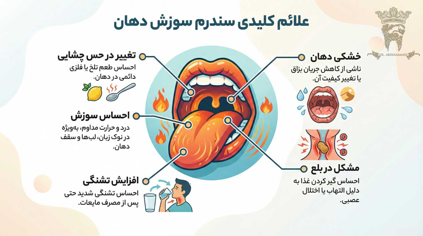 آشنایی کامل با سندرم سوزش دهان 1 علائم سندرم سوزش دهان (BMS)