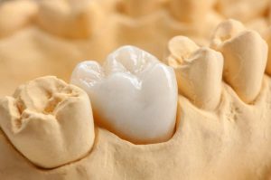 آناتومی دندان؛ ساختار، انواع دندانها و تفاوت دندانهای شیری و دائمی 1 Zirconia Dental Crown Brisbane