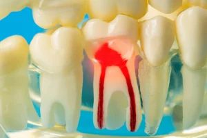آناتومی دندان؛ ساختار، انواع دندانها و تفاوت دندانهای شیری و دائمی 4 ccd tooth pulp