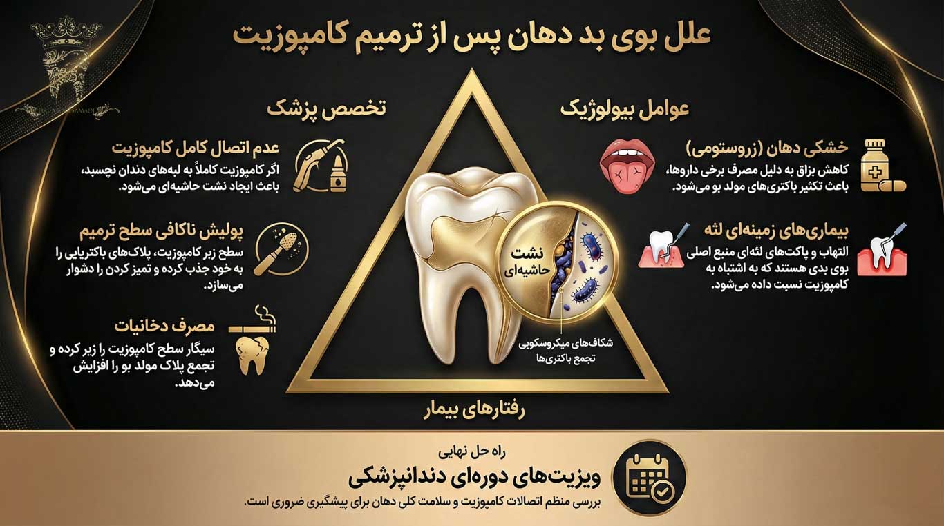بوی بد دهان بعد از کامپوزیت: آیا کامپوزیت باعث بوی بد دهان میشود؟ 2 علل اصلی بوی بد دهان (هالیتوزیس) پس از ترمیم کامپوزیت
