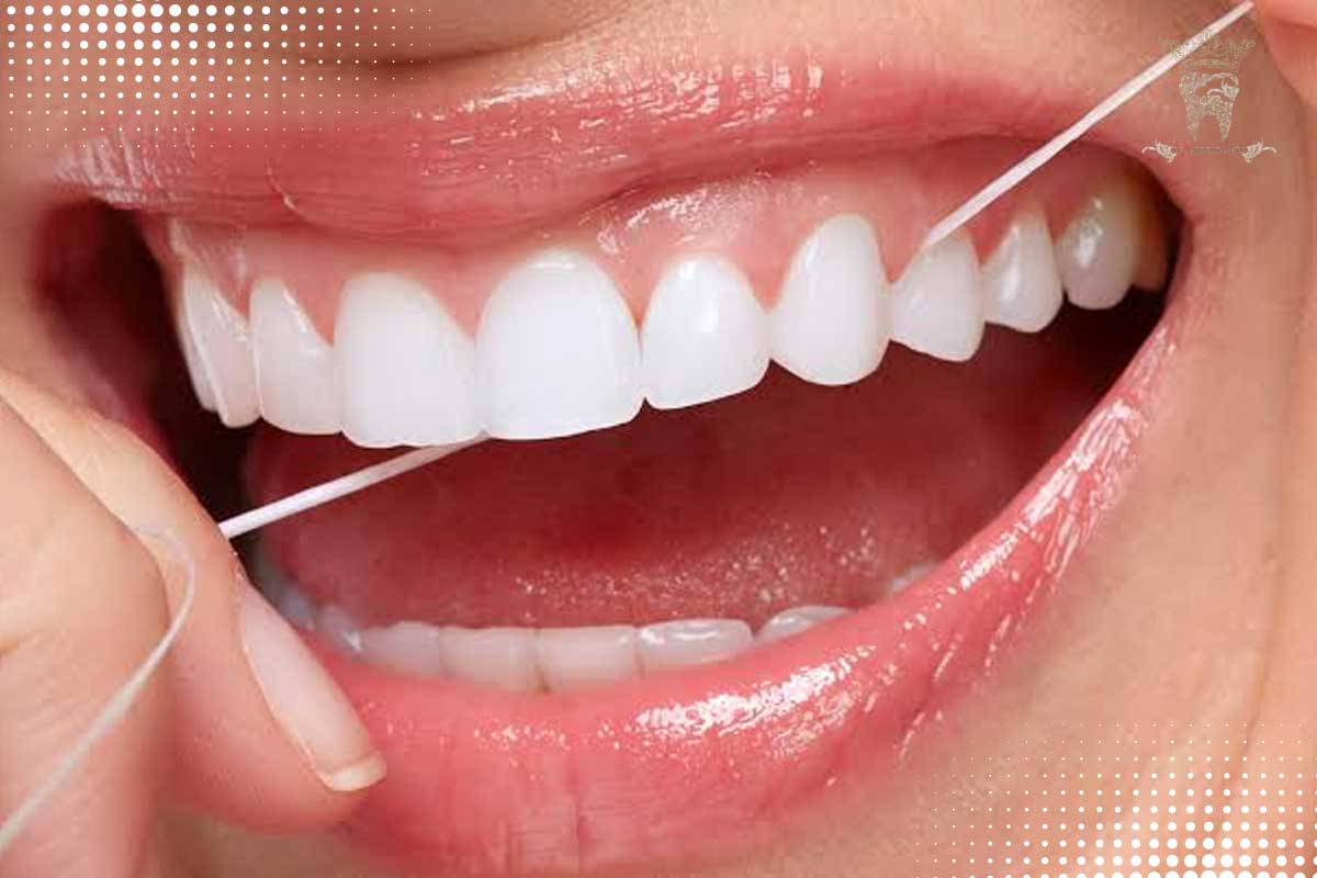 لمینت دندان برای افراد سیگاری؛ آیا انتخاب مناسبی است؟ 2 مراقبت از لمینت دندان برای افراد سیگاری